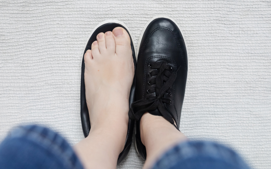 Foot deforming shoes. Incorrect anatomical shoes with flat soles. Small insole size, which causes foot pain. Cause of valgus, calluses, ingrown toenails